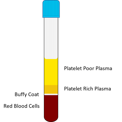 how to prepare prp